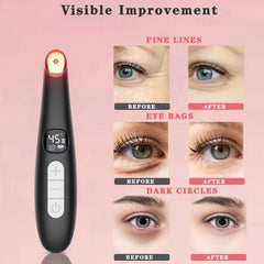 LED Eye Massager Wand for Dark Circles & Puffiness