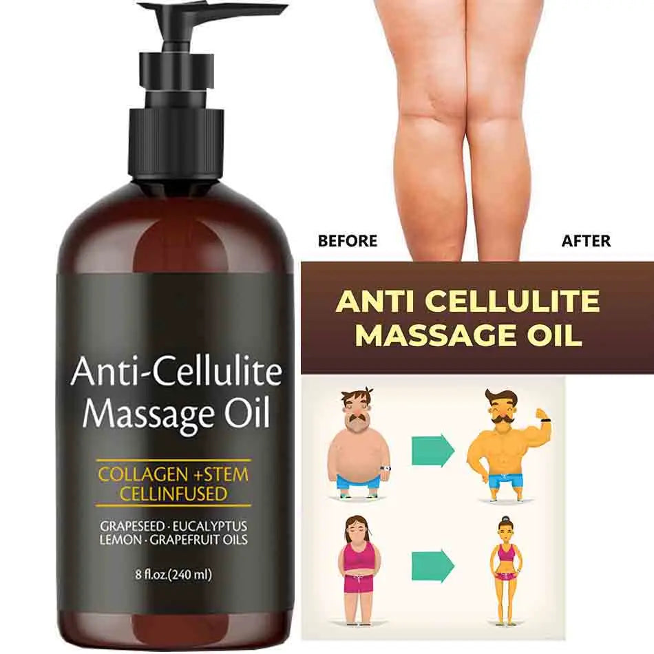 A 240ml Anti Cellulite Massage Oil Infused with Collagen and Stem Cell sits next to before-and-after leg photos, suggesting this skin-tightening, moisturizing body oil helps reduce cellulite.