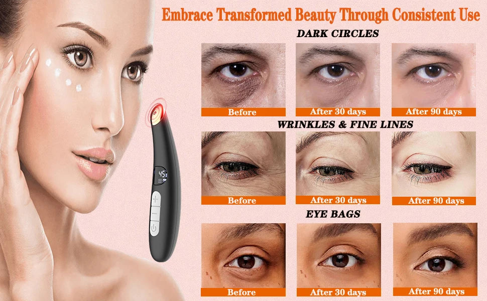 LED Eye Massager Wand for Dark Circles & Puffiness